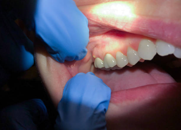 Best Emergency Tooth Extraction in Goose Creek Village, VA